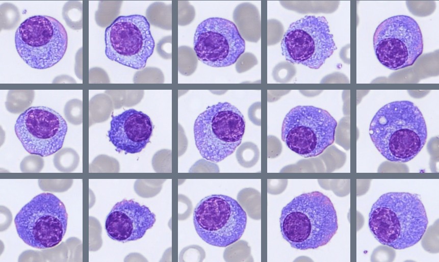 Monthly Cell Challenge #3 2026 plasmacells