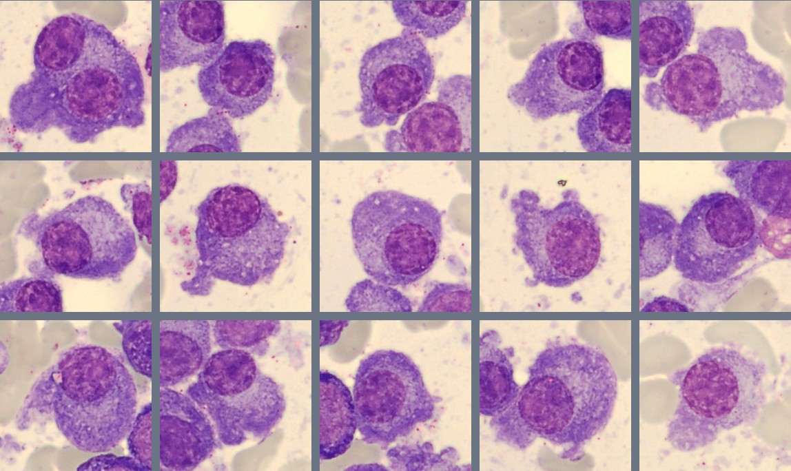 Monthly Cell Challenge #3 2026 Plasmacells