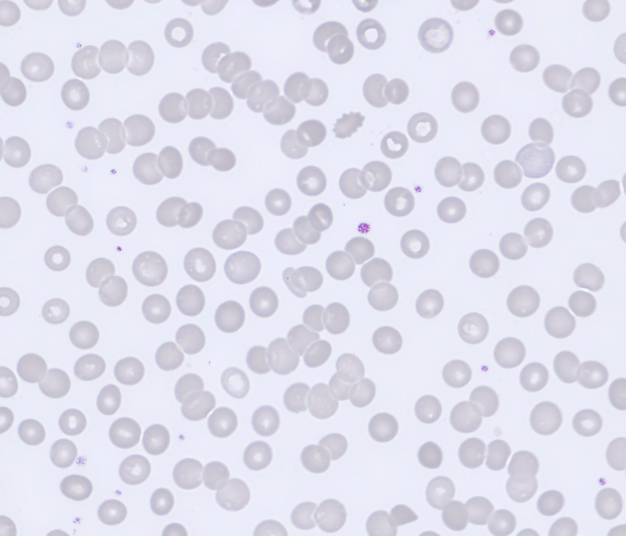 Monthly Cell Challenge #3 2026 RBC overview zoom