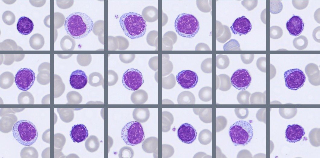 Monthly Cell Challenge #3 2026 lymph