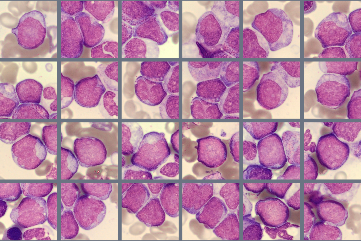 BMA Blasts Monthly Cell Challenge April 2026