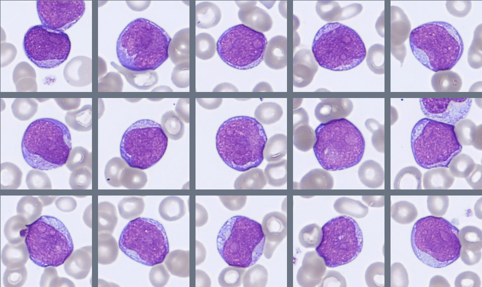 Blasts Monthly Cell Challenge April 2026