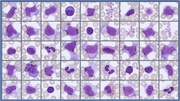 Sample of cells classified in the Global Test 2026:1