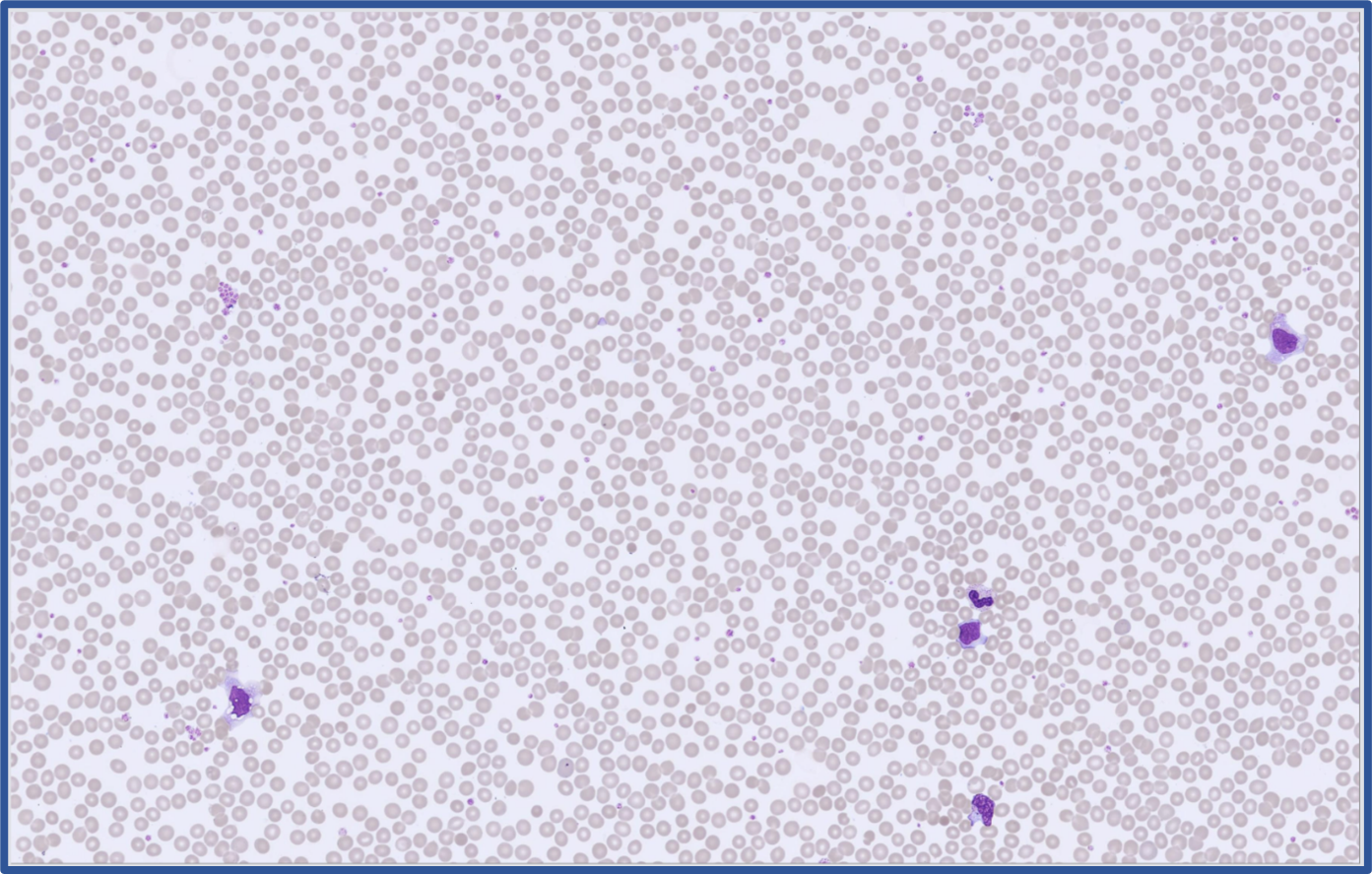 Global Test 2026:1 RBC Overview