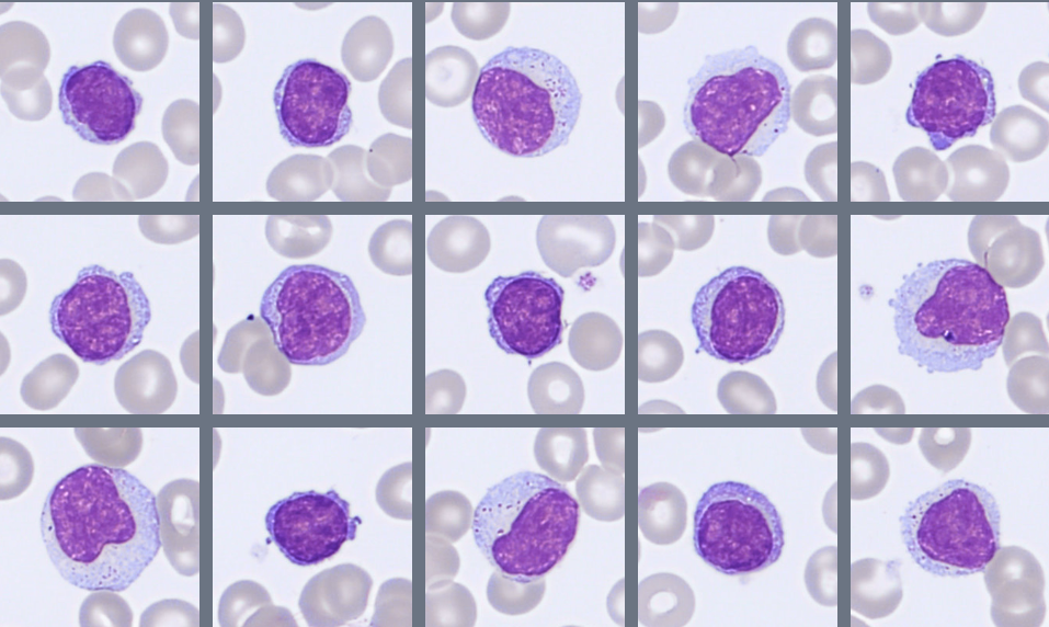 Lymphocytes Monthly Cell Challenge April 2026