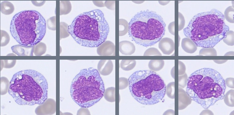 Monocytes Monthly Cell Challenge April 2026