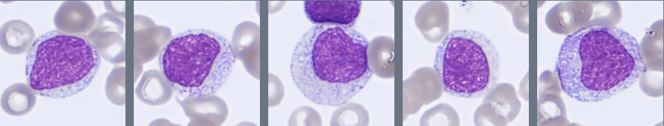 Myelocytes Monthly Cell Challenge April 2026