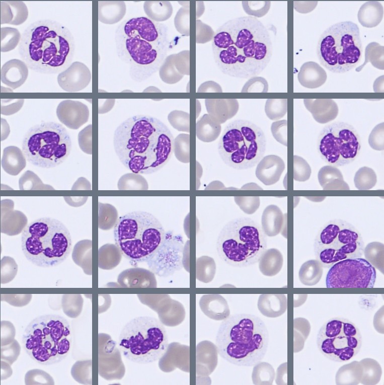 Neutrophils Monthly Cell Challenge April 2026