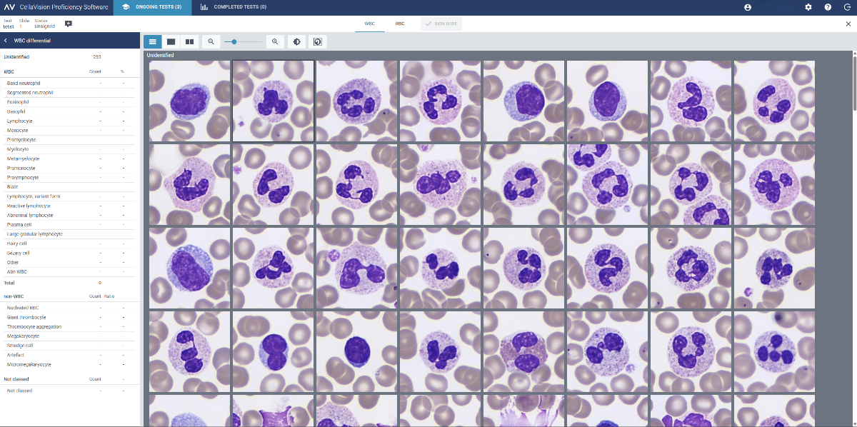 Blood cell images