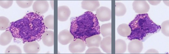 Basophils Monthly Cell Challenge 07_2026
