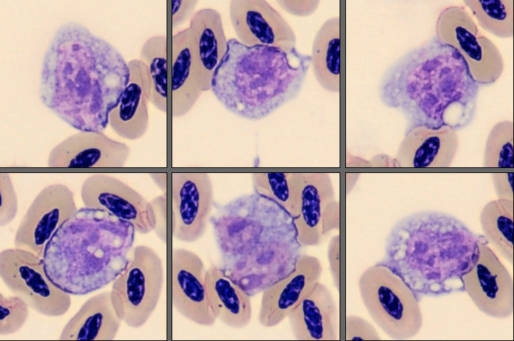Monocytes from Monthly Cell Challenge June 2026
