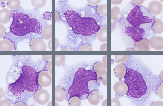 Monocytes Monthly Cell Challenge 07_2026