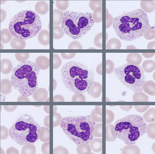 Neutrophils Monthly Cell Challenge July 2026