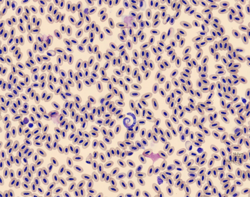 RBC from Monthly Cell Challenge June 2026