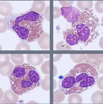 Eosinophils Monthly Cell Challenge 07-2026