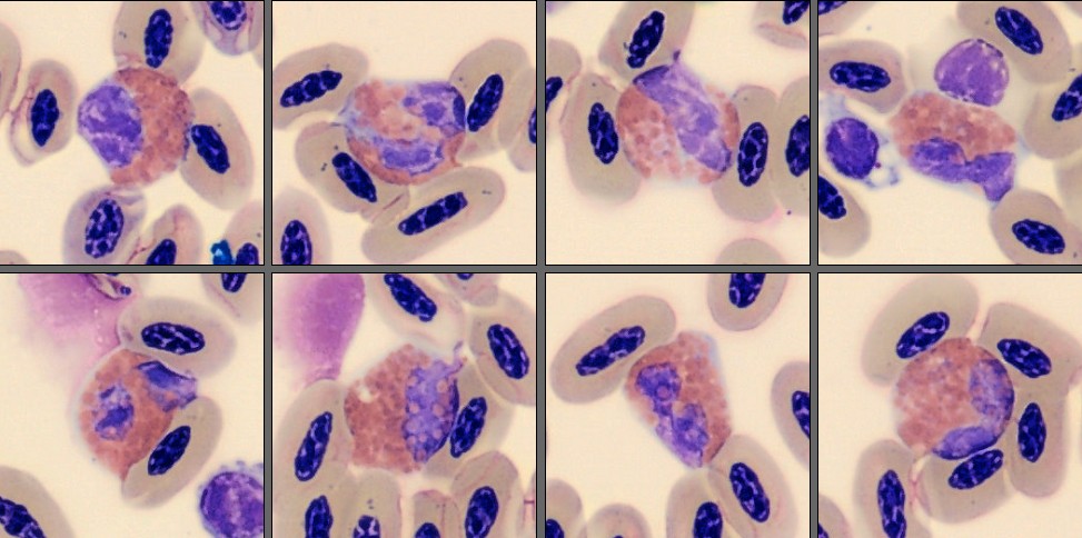 Eosinophils from Monthly Cell Challenge June 2026