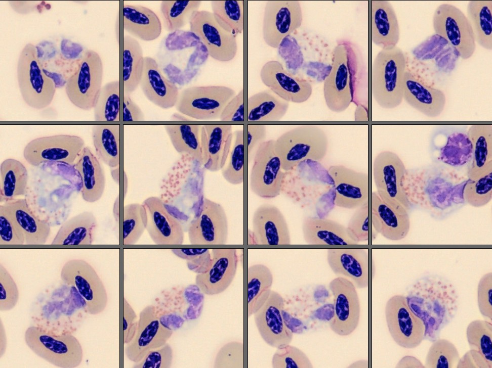 Heterophils from Monthly Cell Challenge June 2026
