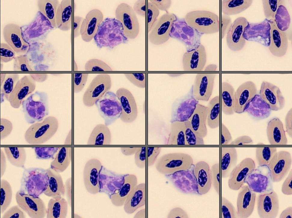 Lymphocytes from Monthly Cell Challenge June 2026
