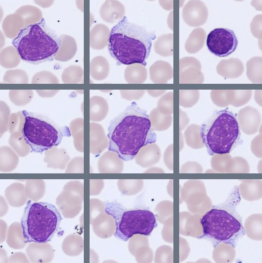 Lymphocytes Monthly Cell Challenge 07_2026