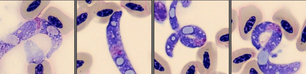 Parasite from Monthly Cell Challenge June 2026