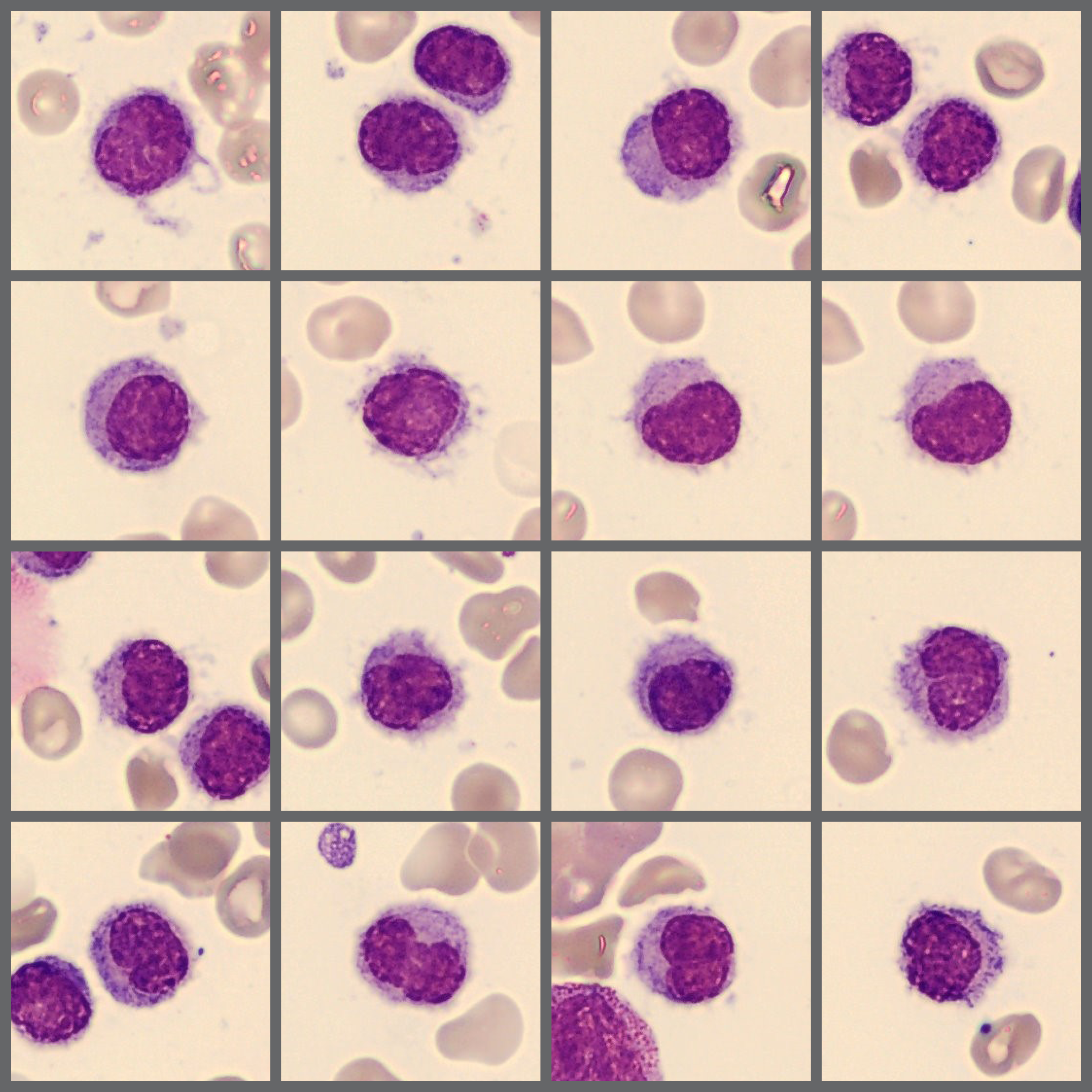 Digital Bone Marrow cell images