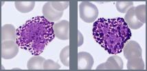 Basophil cell images