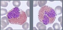 Peripheral blood cell image