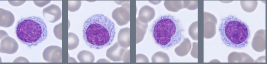 Digital blood cell images