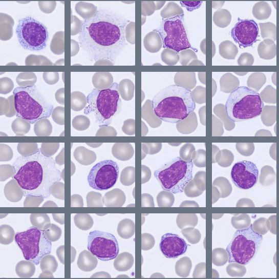 Digital blood cell images