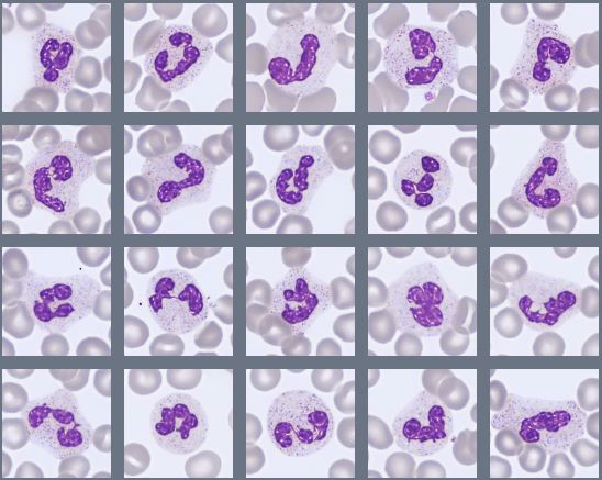 Peripheral Blood cell image