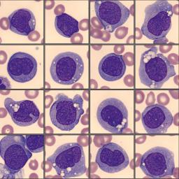 Monoblasts from the CellaVision Monthly Cell Challenge April 2025