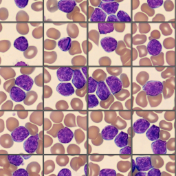 Lymphocytes from the CellaVision Monthly cell challenge May 2025