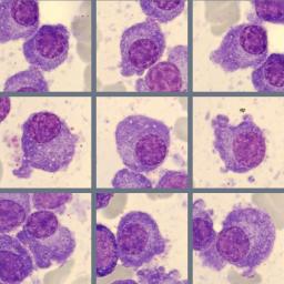 Monthly Cell Challenge #3 2026 Plasmacells