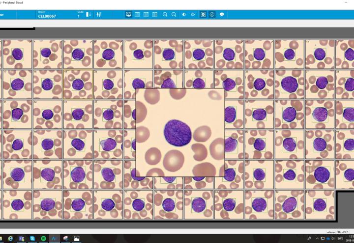 Peripheral blood