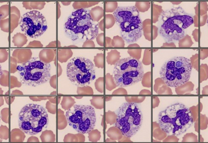 Anaplasmosis cells