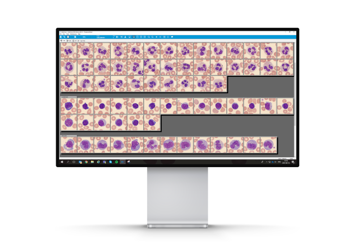 CellaVision Peripheral Blood Application Software