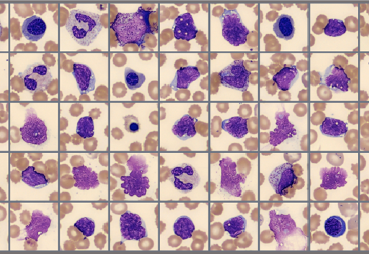 Global Test 2024:2 sample of cells