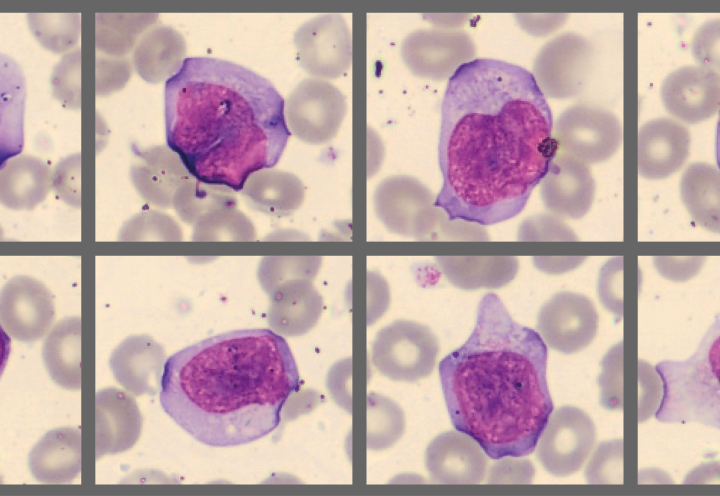 Monthly cell challenge 1 - Reactive lymphocyte