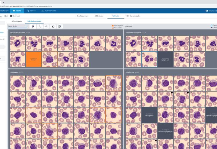 Results cell disagreement CellaVision Proficiency Software