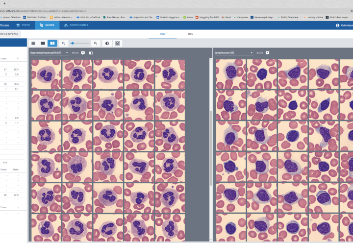 CellaVision Proficiency Software two-cell gallery