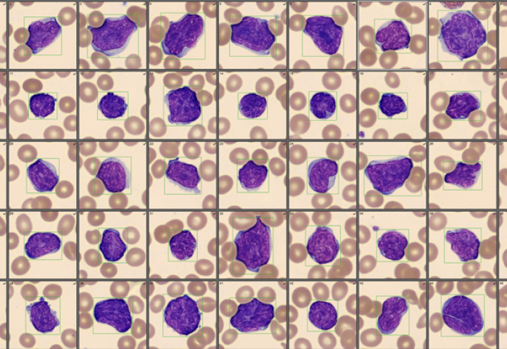 Most cells exhibited nuclear shape irregularities / Monthly Cell Challenge #2