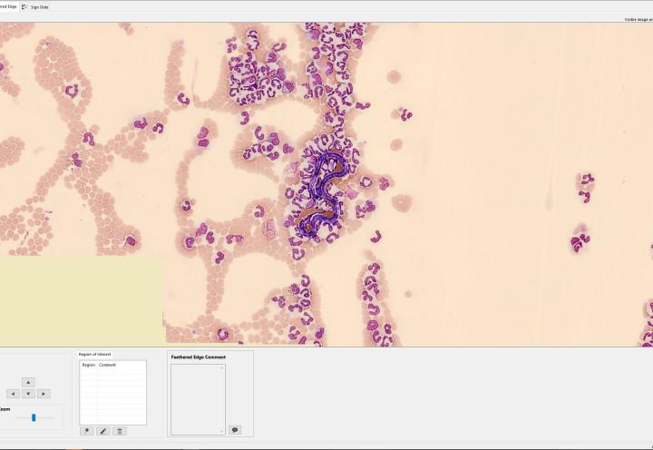 Full Field view CellaVision