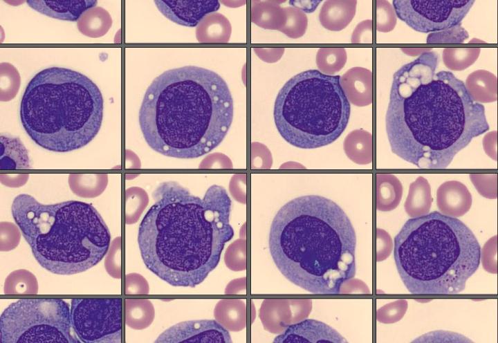 Monoblasts from the CellaVision Monthly Cell Challenge April 2025
