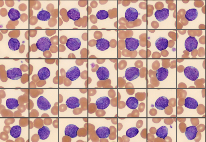 Blasts from the monthly cell challenge June 2025