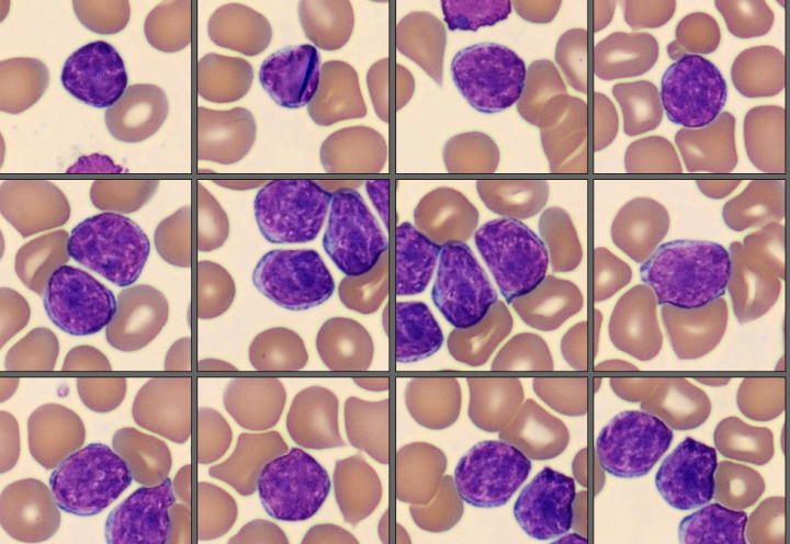 Lymphocytes from the CellaVision Monthly cell challenge May 2025