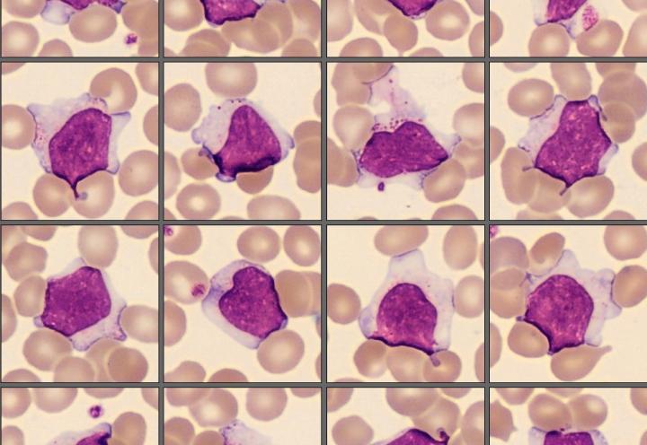 Lymphocytes from the CellaVision Monthly cell challenge December 2025