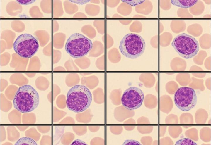 Lymphocytes from the CellaVision Monthly cell challenge November 2025