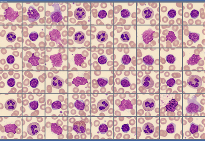 Sample of cells Global Test 2025:4