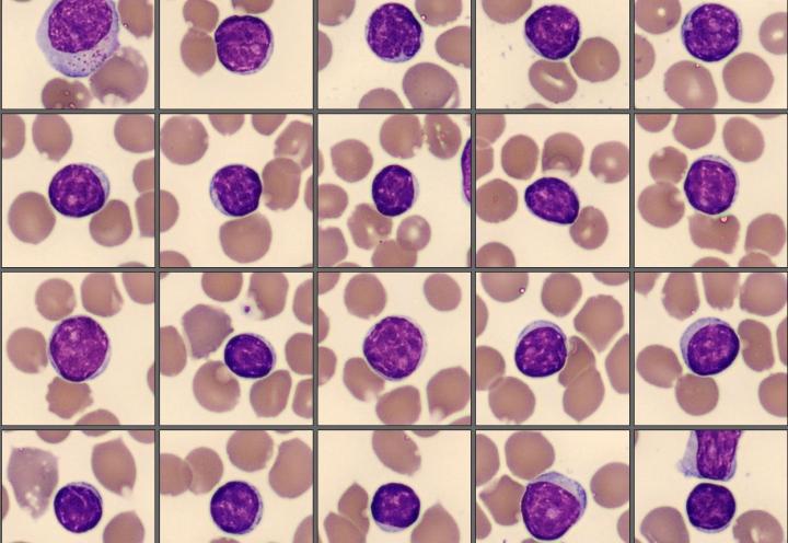 Lymphocytes CellaVision Monthly Cell Challenge January 2026