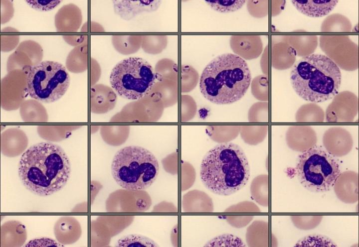 Neutrophils, monthly cell challenge February 2026